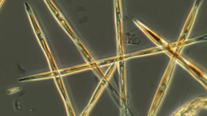 Microscope image of pseudo-nitzschia